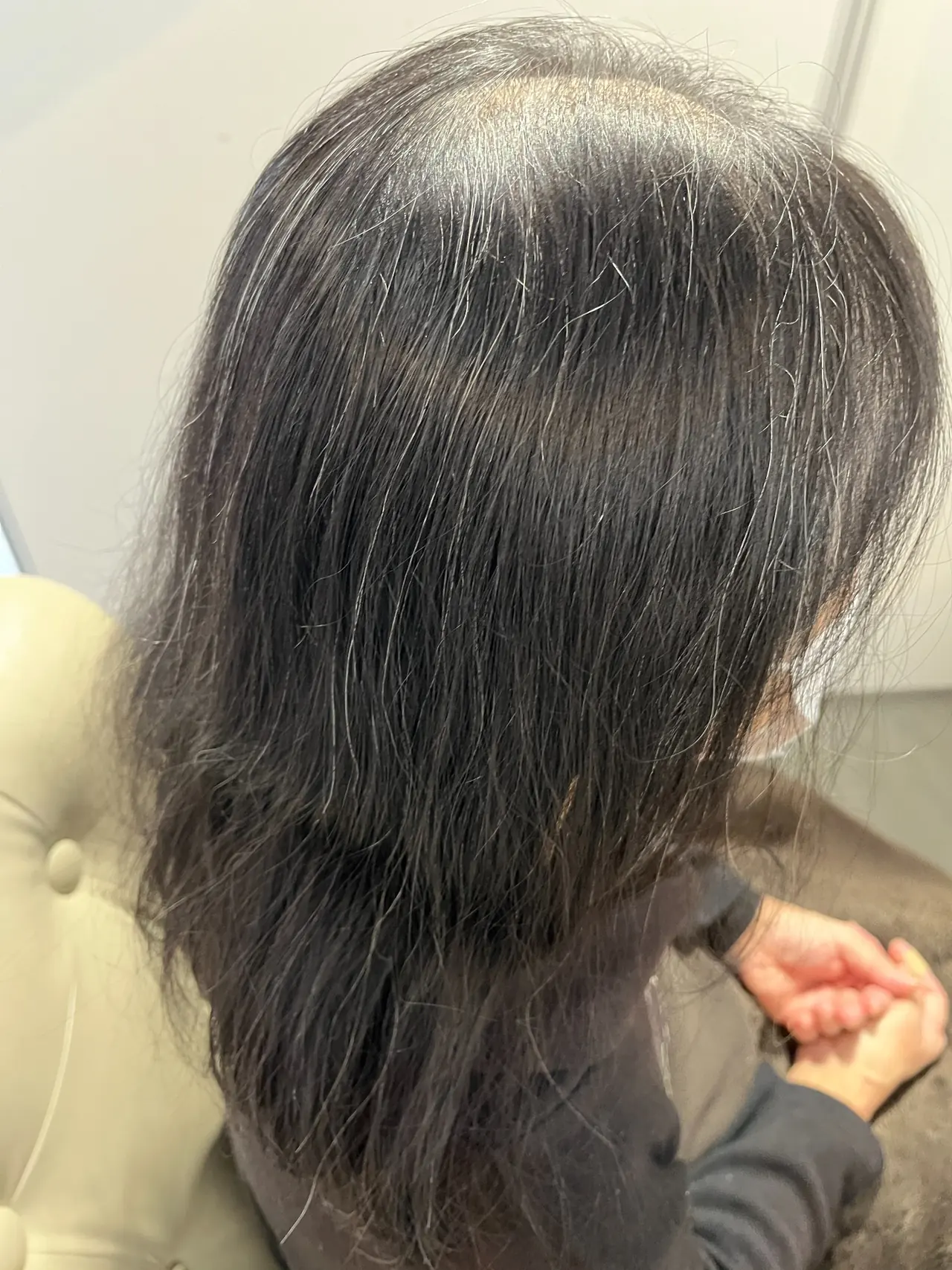 施術前の髪の状態 1