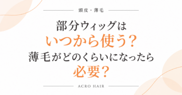 部分ウィッグはいつから使う？薄毛がどのくらいになったら必要？