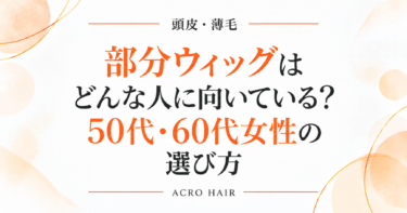 部分ウィッグはどんな人に向いている？50代・60代女性の選び方